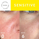 VITAL REPAIR SERUM Skincare Nuori