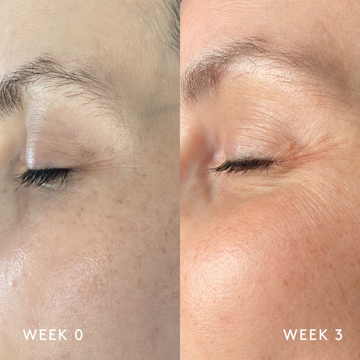 Essential Trio - Dark Spots product NUORI 