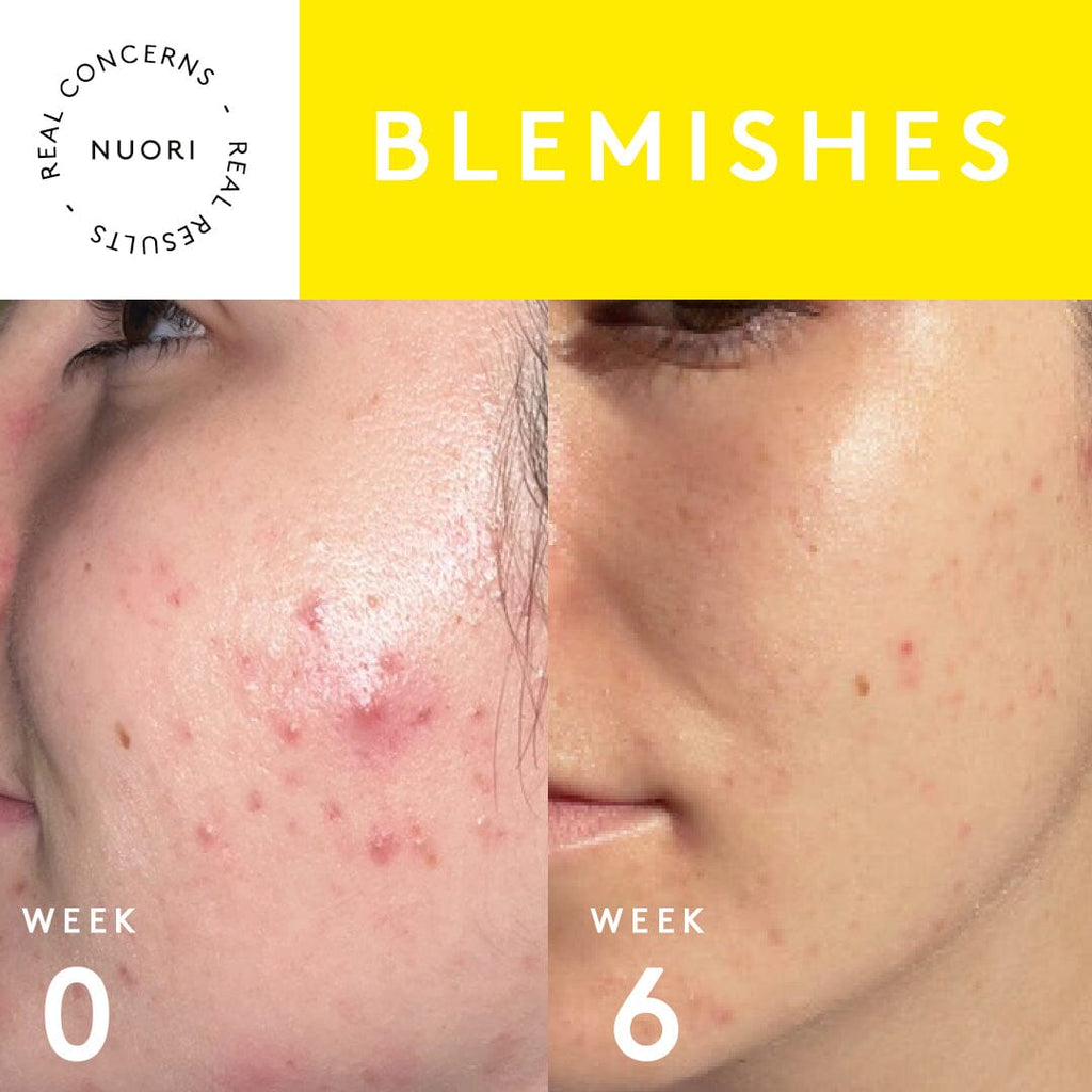 Clarity Mask Skincare Nuori 