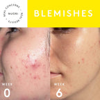 Clarity Mask Skincare Nuori 